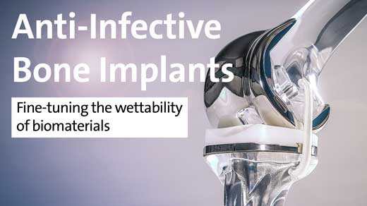 Anti-Infective Bone Implants - Fine-tuning the wettability of biomaterials