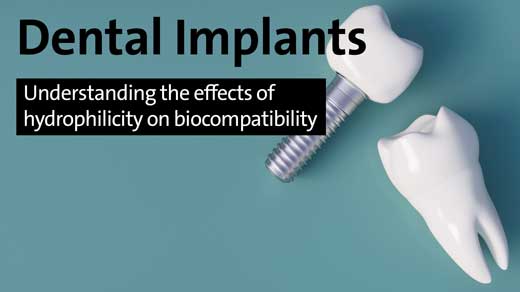 Dental Implants - Understanding the effects of hydrophilicity on biocompatibility